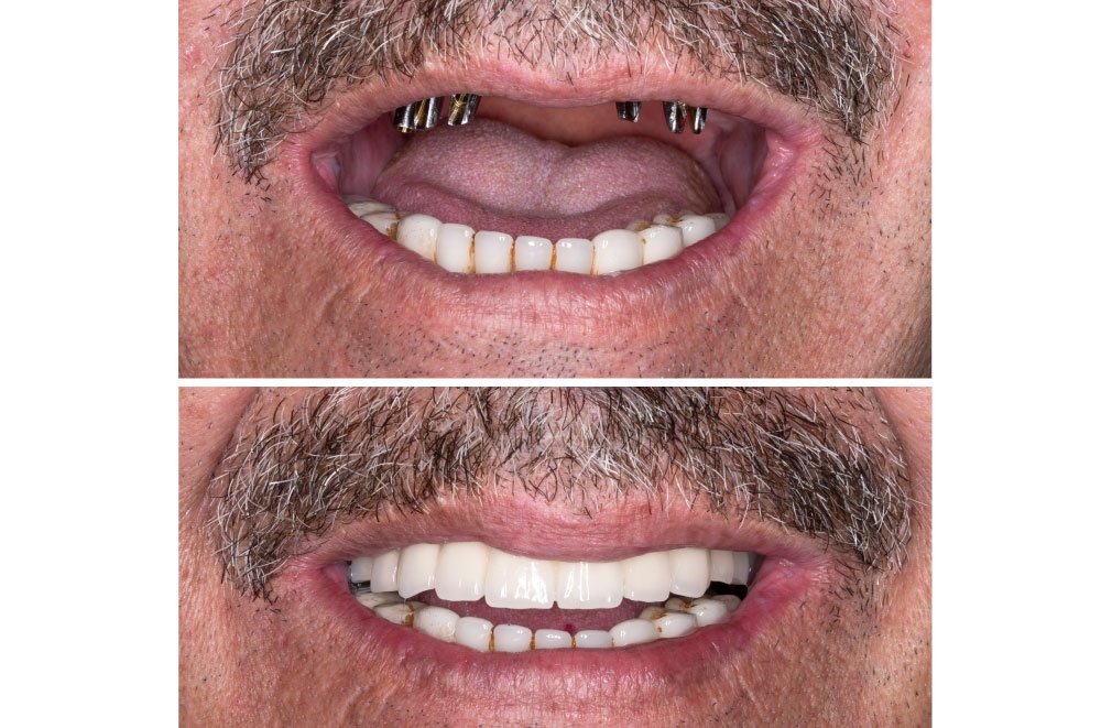 Issaquah Dentist Office