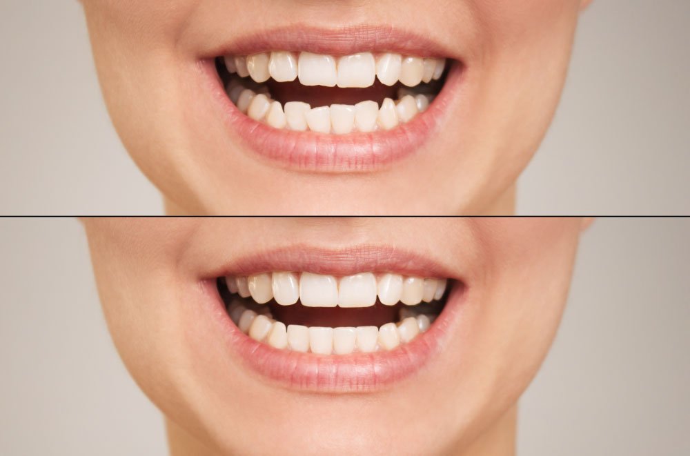 Issaquah Dentist Office