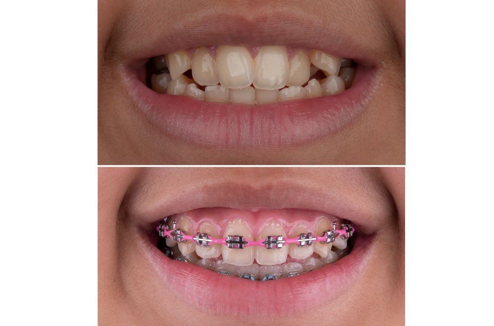Issaquah Dentist Office