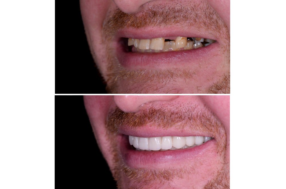 Issaquah Dentist Office
