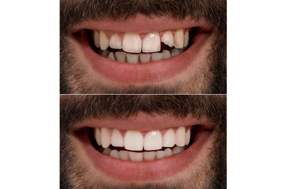Issaquah Dentist Office