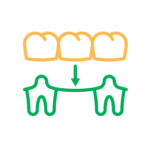 Dental Crowns and Bridges