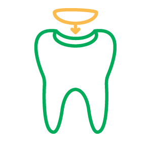 Dental Fillings