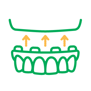 Issasquah Full and Partial Dentures